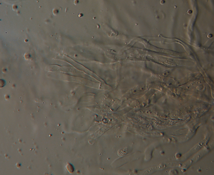 Aleurodiscus amorphus (Fr.)Schroeter
